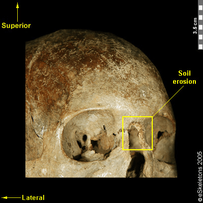 image 2 Simplyforensic