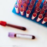 Pexels Photo 4226902 glass tubes with colorful liquids on table Simplyforensic